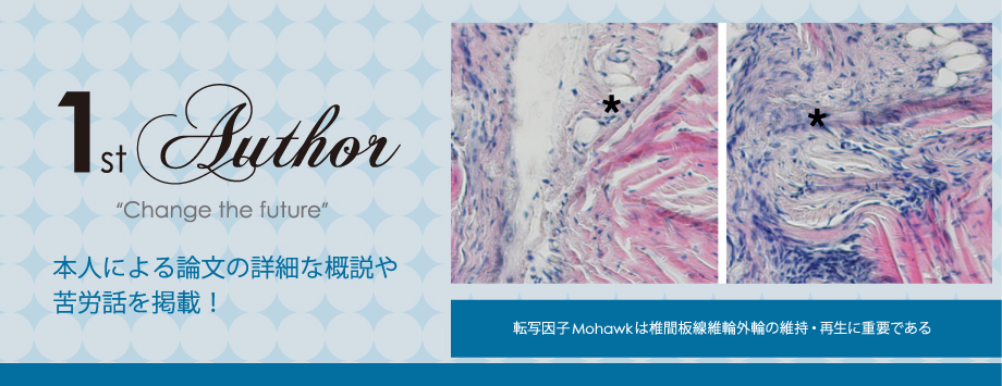 The Japanese Society for Bone and Mineral Reserch