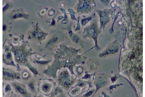 The Chemical Dynamics of Bone Mineral