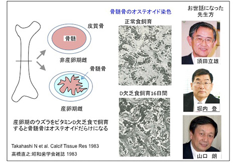 私の破骨細胞研究