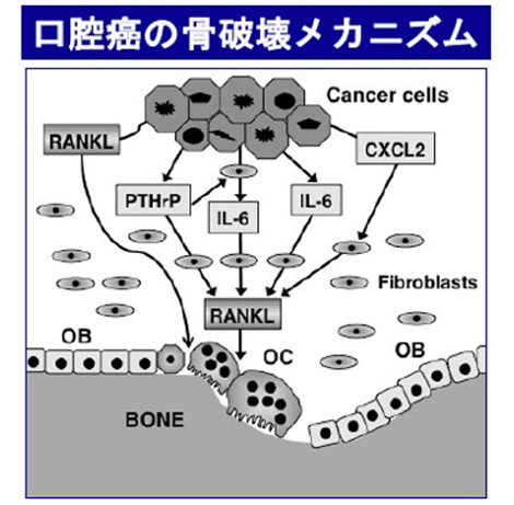 骨代謝研究と人々との出会い